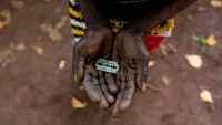 Journée internationale de tolérance zéro à l’égard des mutilations génitales féminines : « Unissons-nous, finançons, agissons pour mettre fin aux mutilations génitales féminines » (Par Vanessa Moungar)